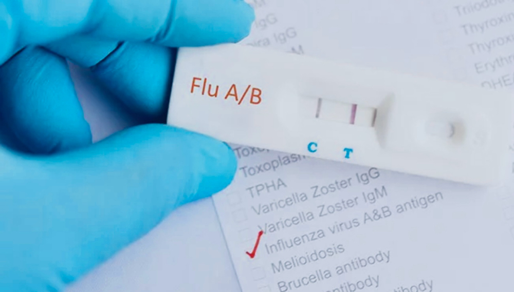 Influenza test