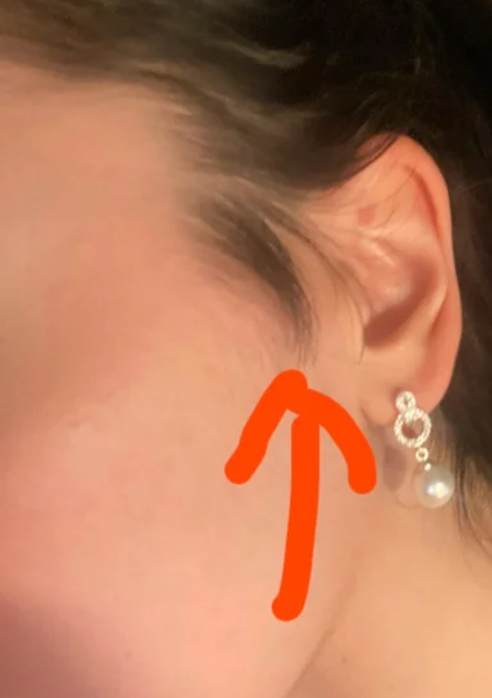 Sideburns Or Cheeks
