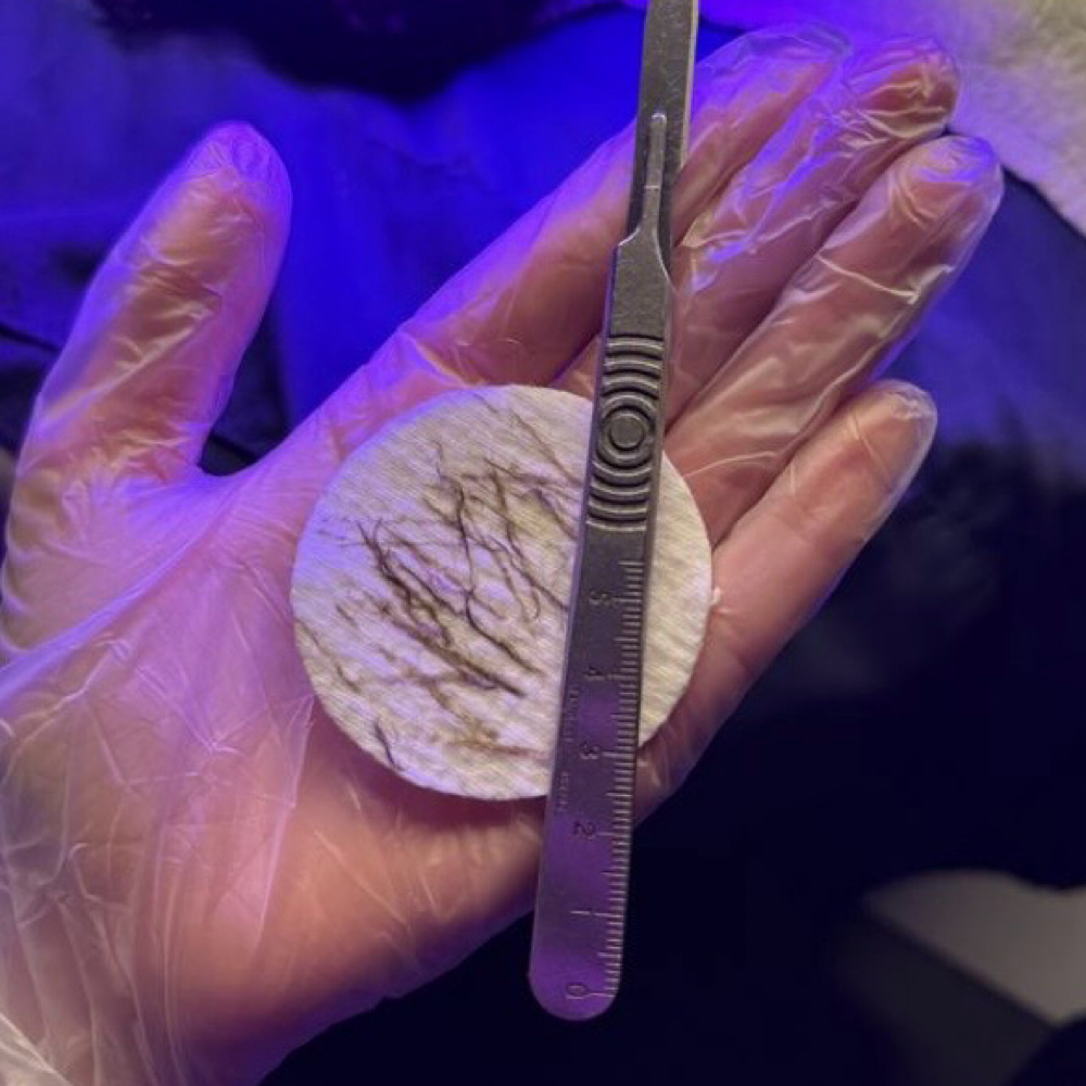 Derma-GLOW at ADORB ME AESTHETIC in Flint, MI