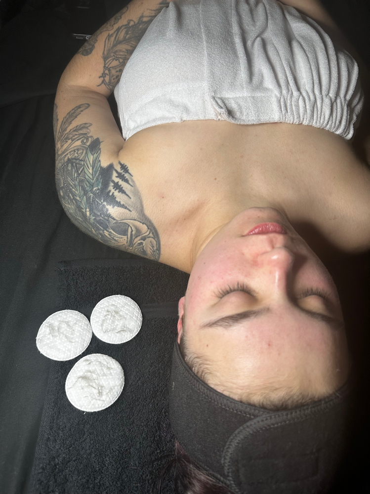 Dermaplaning