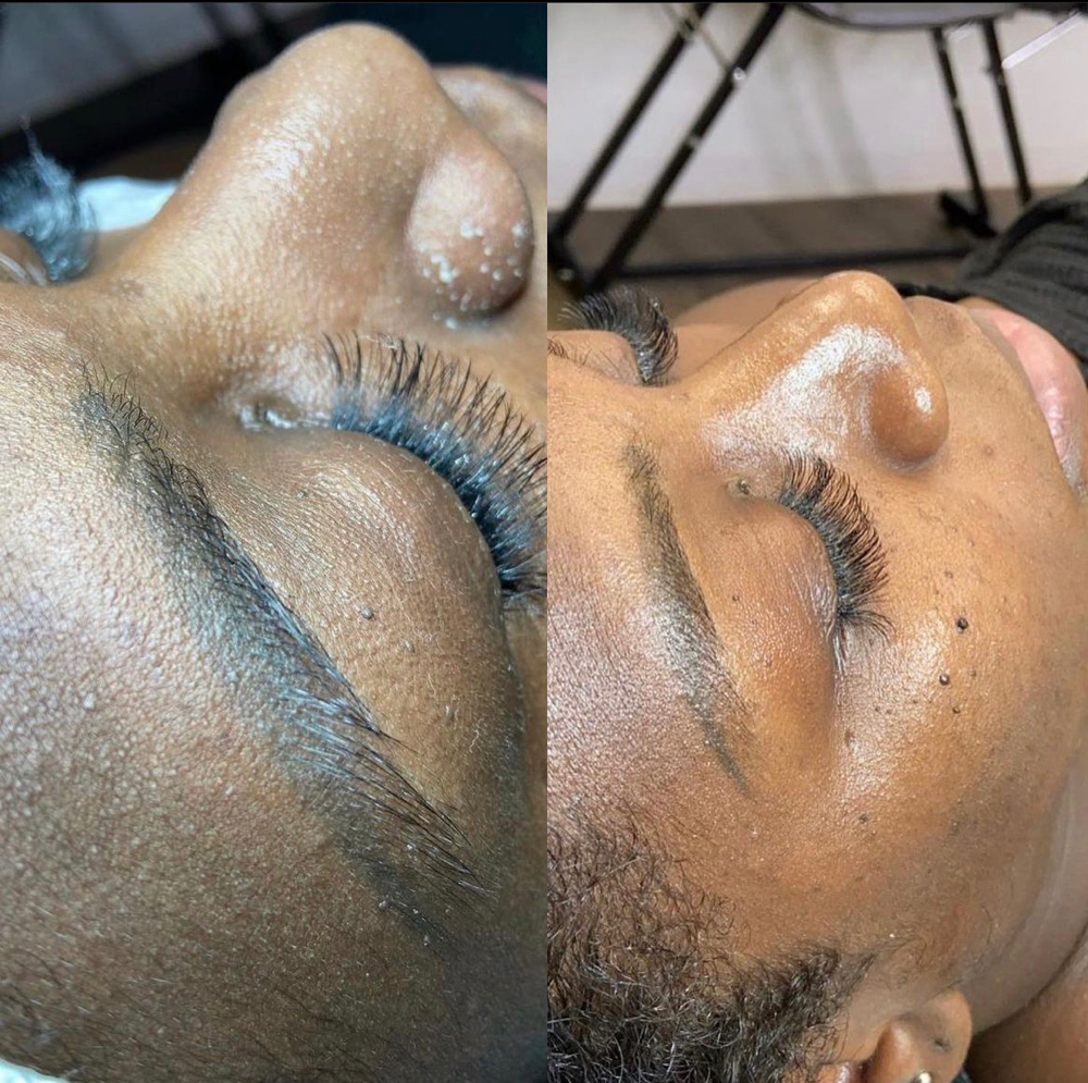 Deep Pore Cleansing Facial