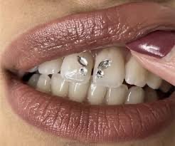 Tooth Gems Design (2 Teeth)