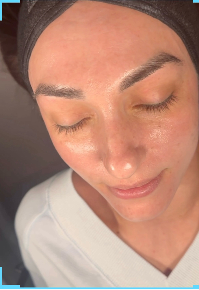 Consultation Facial Services