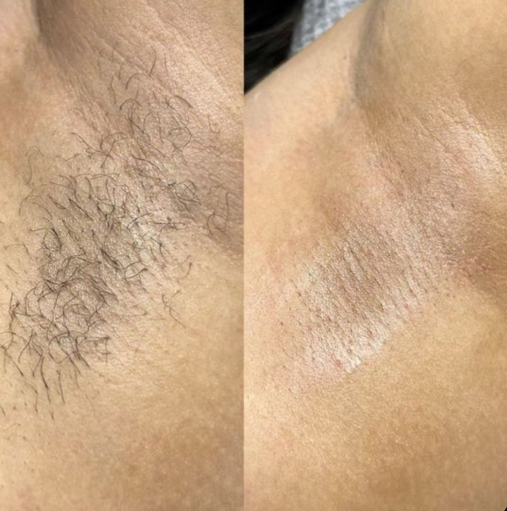Underarm Wax