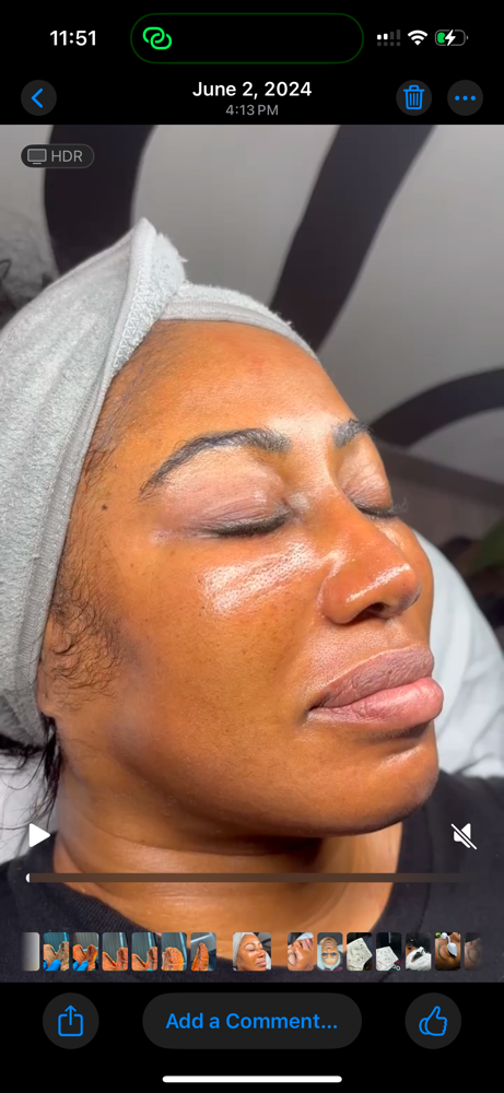 CUSTOM FACIAL