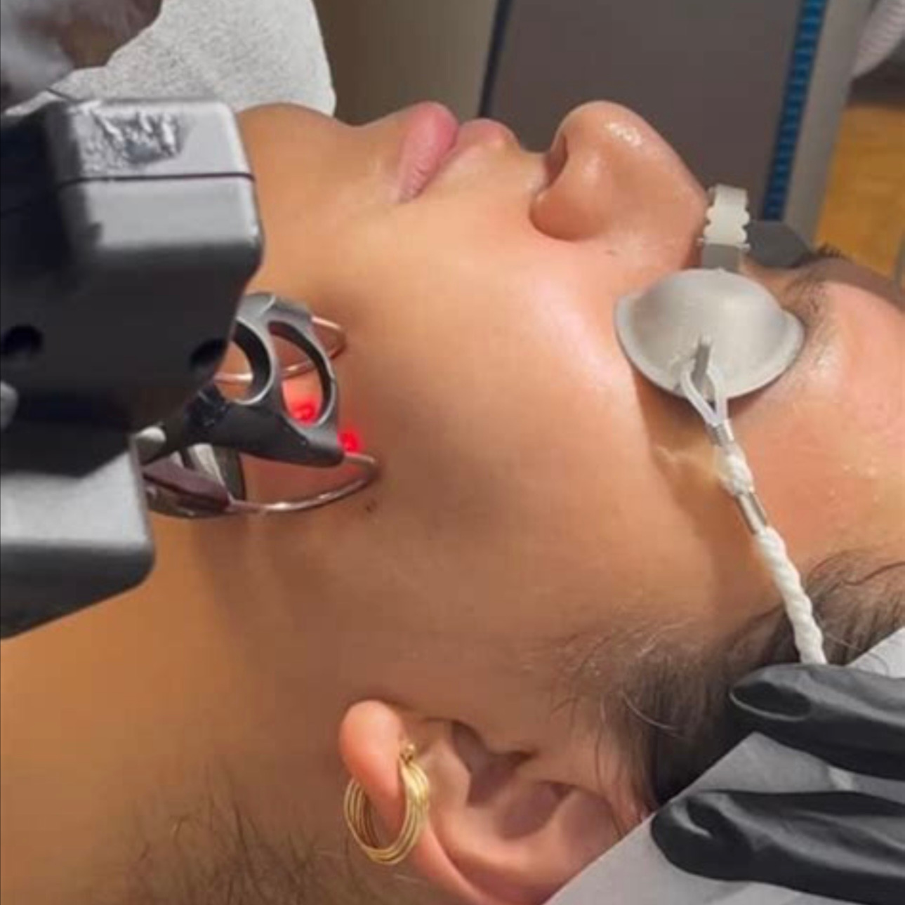 🌿 Precision CO₂ Rejuvenation