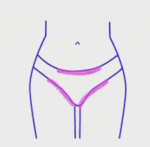 Bikini Line (V)