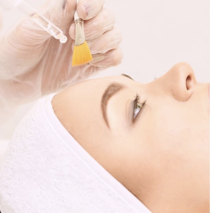 Chemical  Peel ( 3 Layers/passes) at Derma By Debbie in Rusk, TX