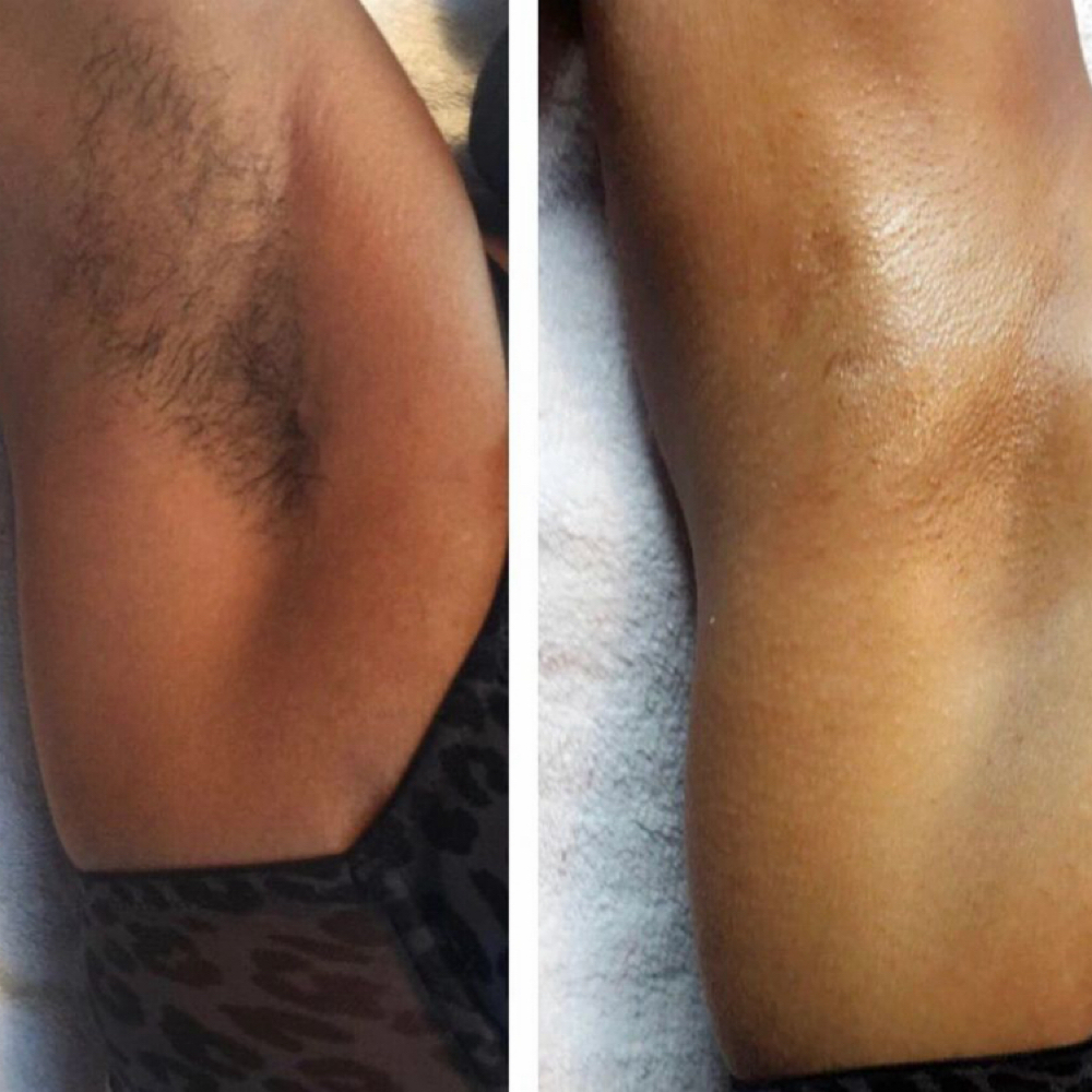 ✨Underarm Wax at iWink Beauty Bar LLC in Chicago, IL