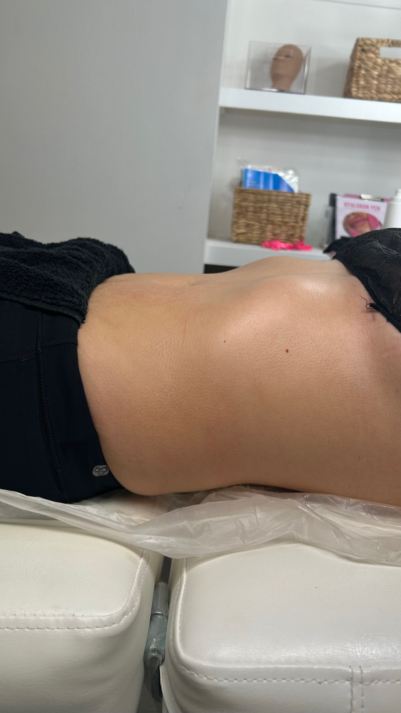 Winter Snatched Body Package Trial