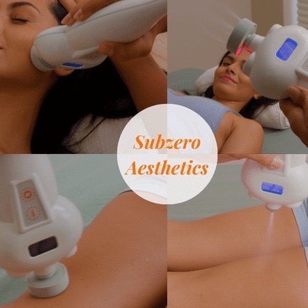 Cryosculpt- Initial Consult & Intro at Salus Wellness of WNY in Buffalo, NY