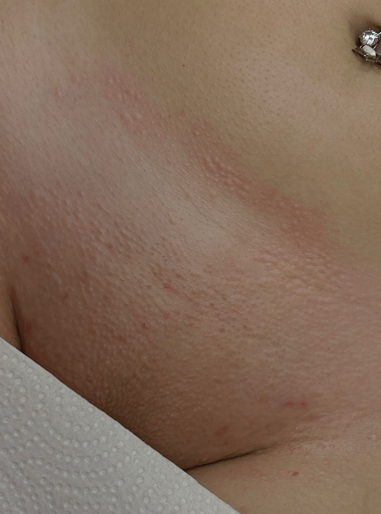 Bikini Full at Dose Of Beauty in New Britain, CT