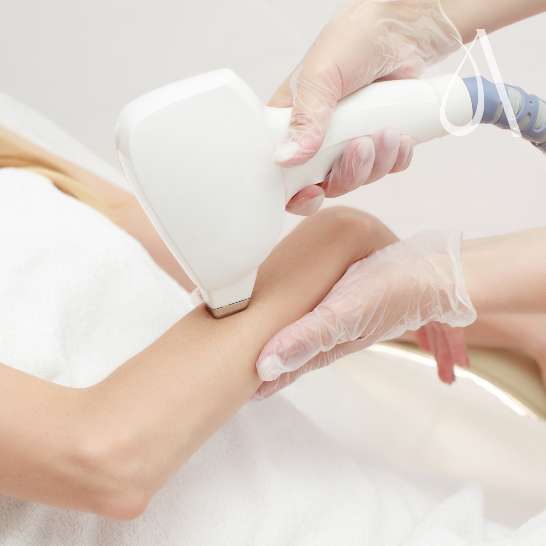 Laser - Half arms - 1 session at Ambar Aesthetics in Kissimmee, FL