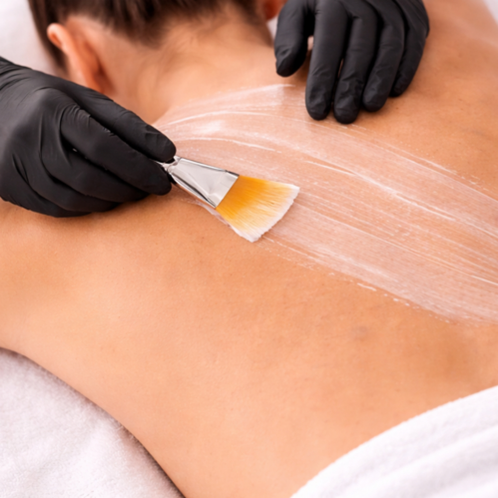 Back Facial at Karma Beauty Spa in Plymouth, MI