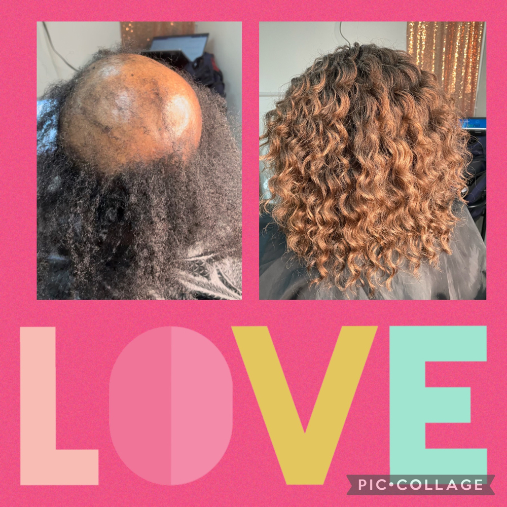 Alopecia Crochet (Custom Install)