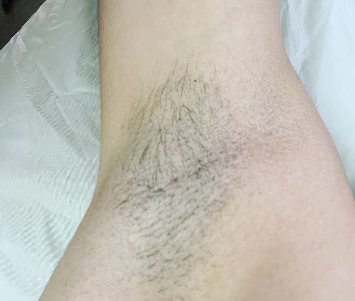 Underarm Wax