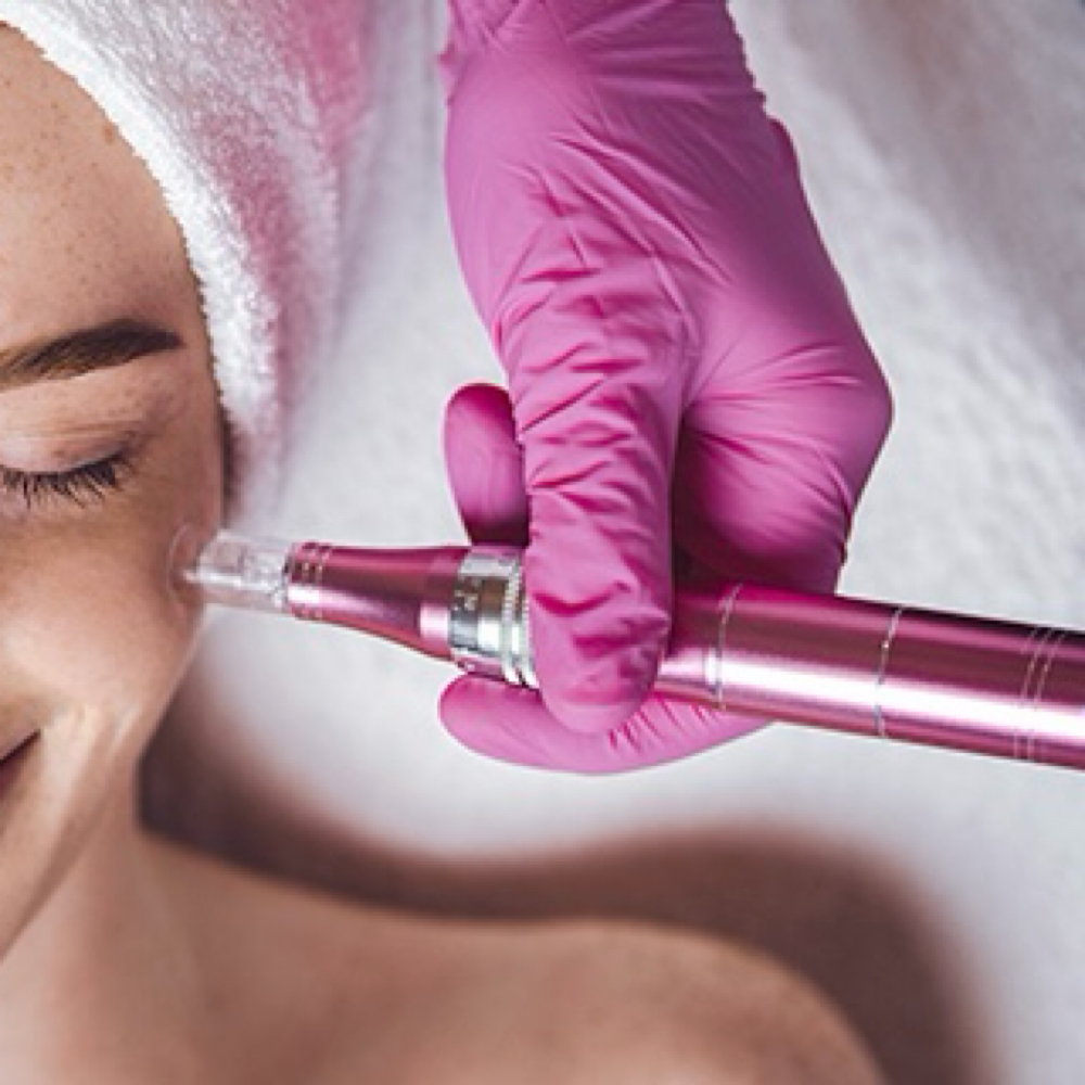 Microneedling - Radiance Boost at Safe Haven MedSpa in McAllen, TX