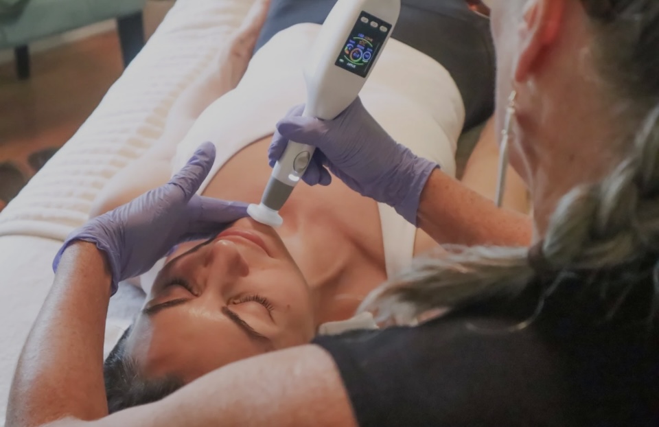 Jet Plasma - Face & Body