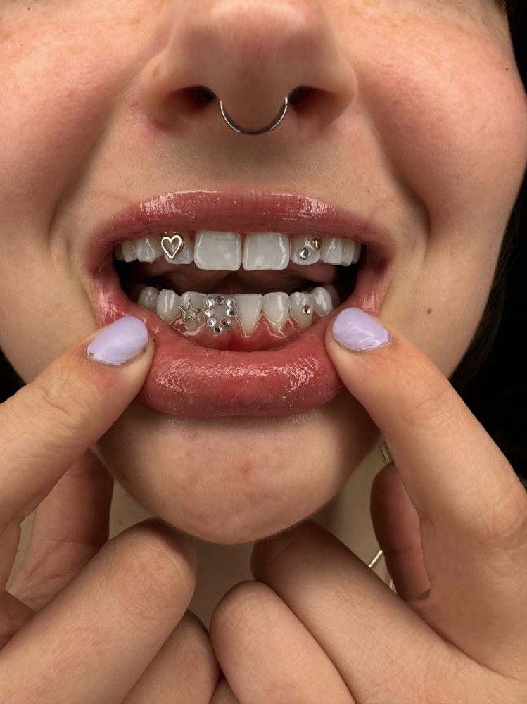 Iced Out (6-8 Teeth)