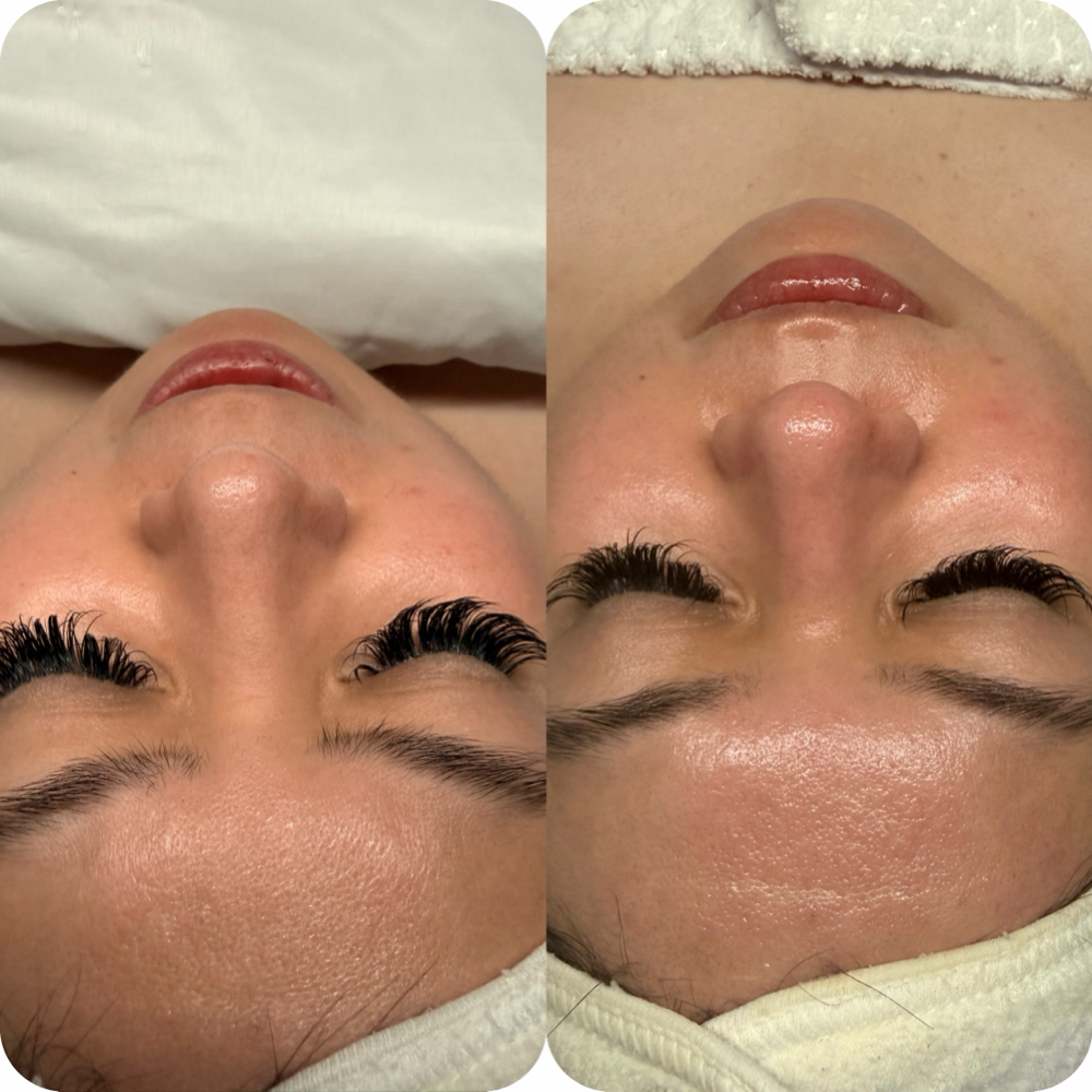 Lavish Signature Facial at Lavish Love Aesthetics in Southlake, TX