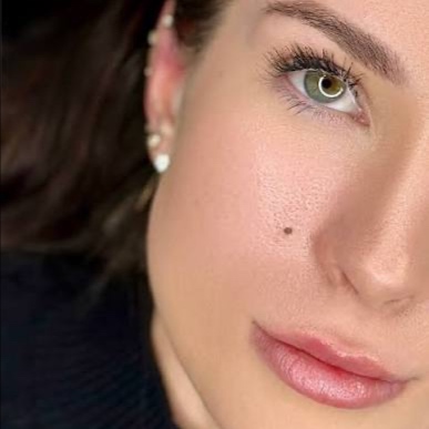 Beauty Mark Enhancement at Taylor  Leeann Aesthetics in Ventura, CA