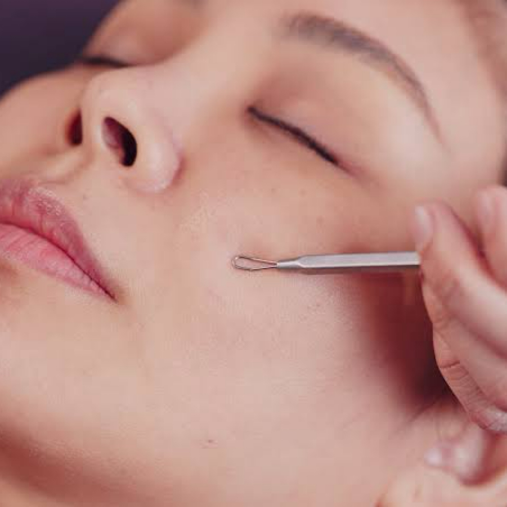 Extractions (facial add-on) at Royal Esthetics in Kearney, NE