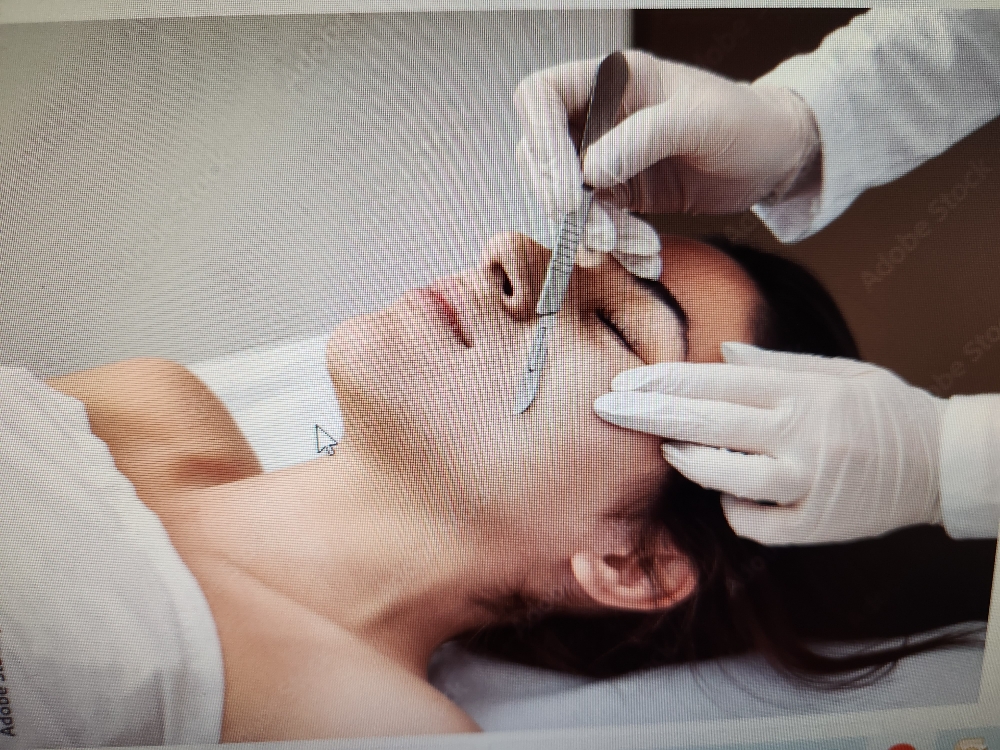 Dermaplane