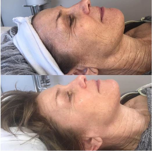 Korean Clinical Facial