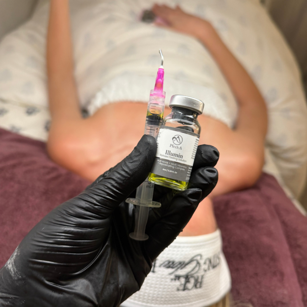 Glow Boost Peel at Glow by Allison in Grapevine, TX