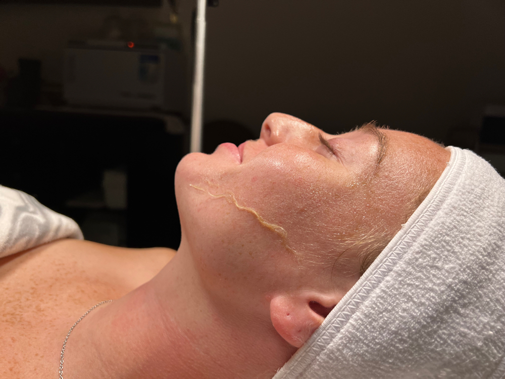 Dermaplane Add On To A Facial