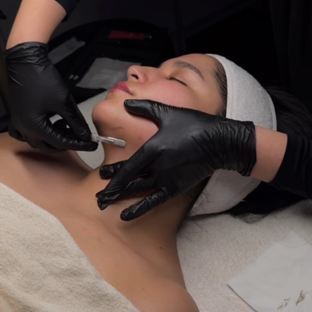 Express Dermaplane at Skin Therapy in Odessa, TX