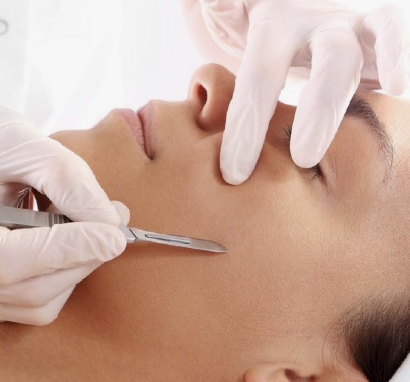 Dermaplane Facial