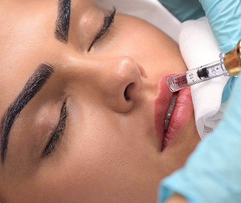 Hyaluronic Pen - 0.5 ML at MUAH in Austin, TX