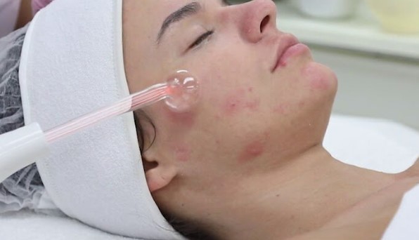 Acne Clearing Facial