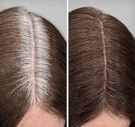 Regrowth