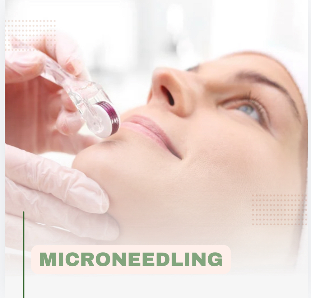 Holistic Facial + Micro-Needling