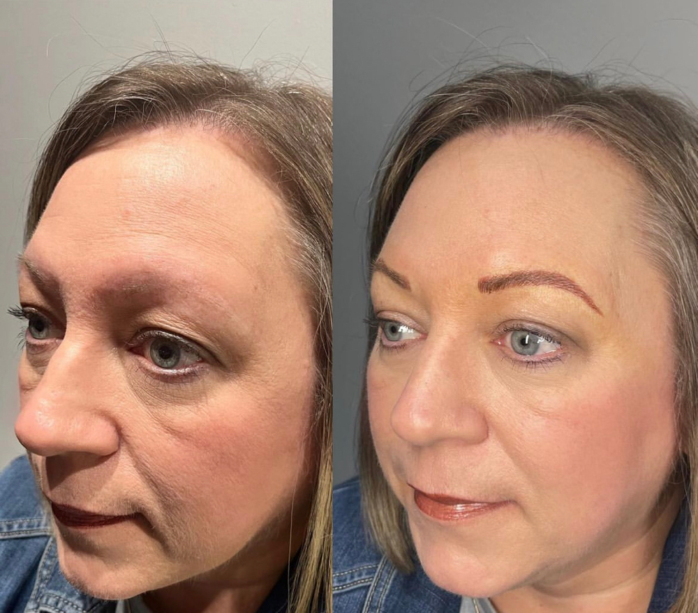 Microblading