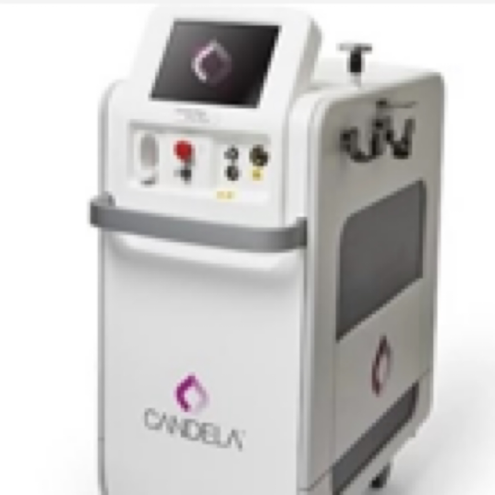Laser Vessel Treatment