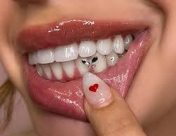 Tooth Gems