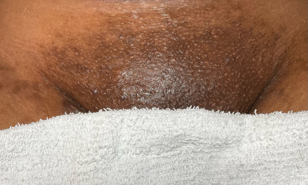 Brazilian Wax
