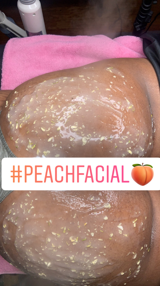 Peach Facial