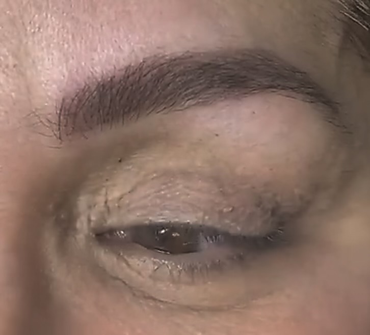 Microblading