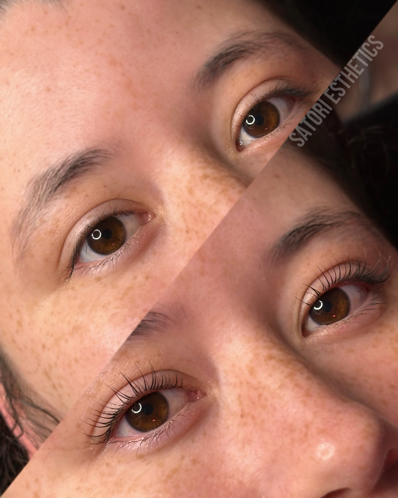 Lash Lift