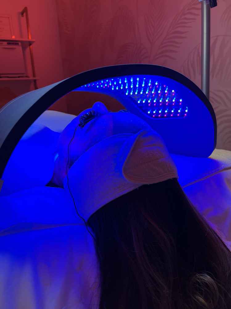 Light Therapy (Add On Service)