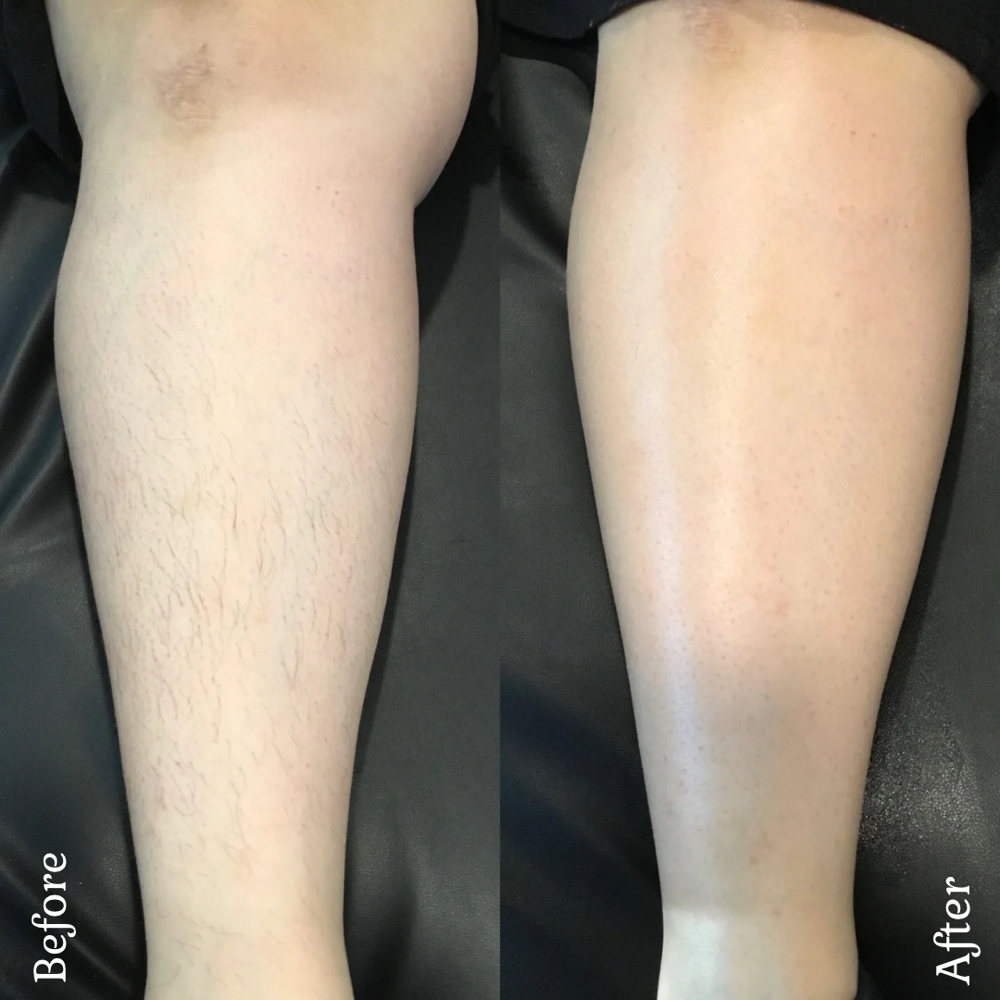 Lower Leg Wax at Bubalu Skin in Elgin, IL