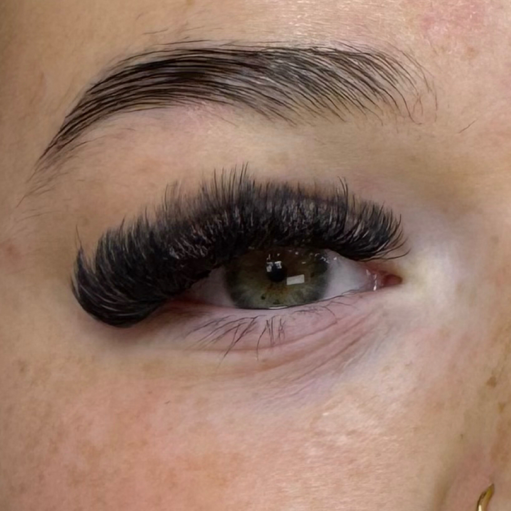 Mega Volume Fills at Esthetic Glow in arlington, WA