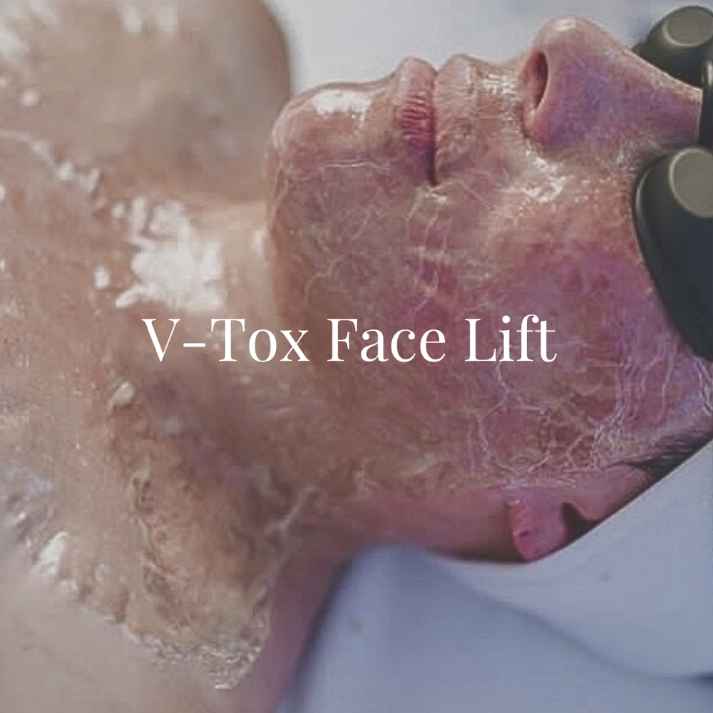 V-TOX FACE LIFTING FACIAL