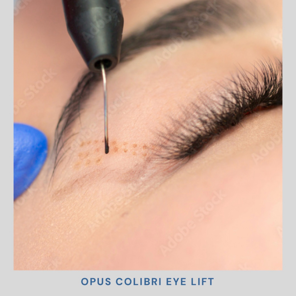 Opus Colibri Eye Lift