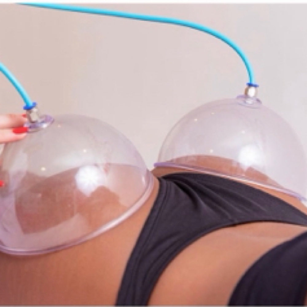 Glute Cupping/ Ventosas Gluteo 🍑 at Aphrodite Curves in Amarillo, TX