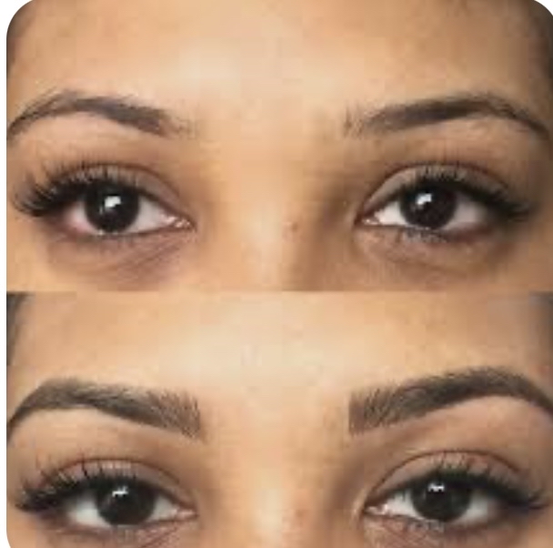 Brow Extension